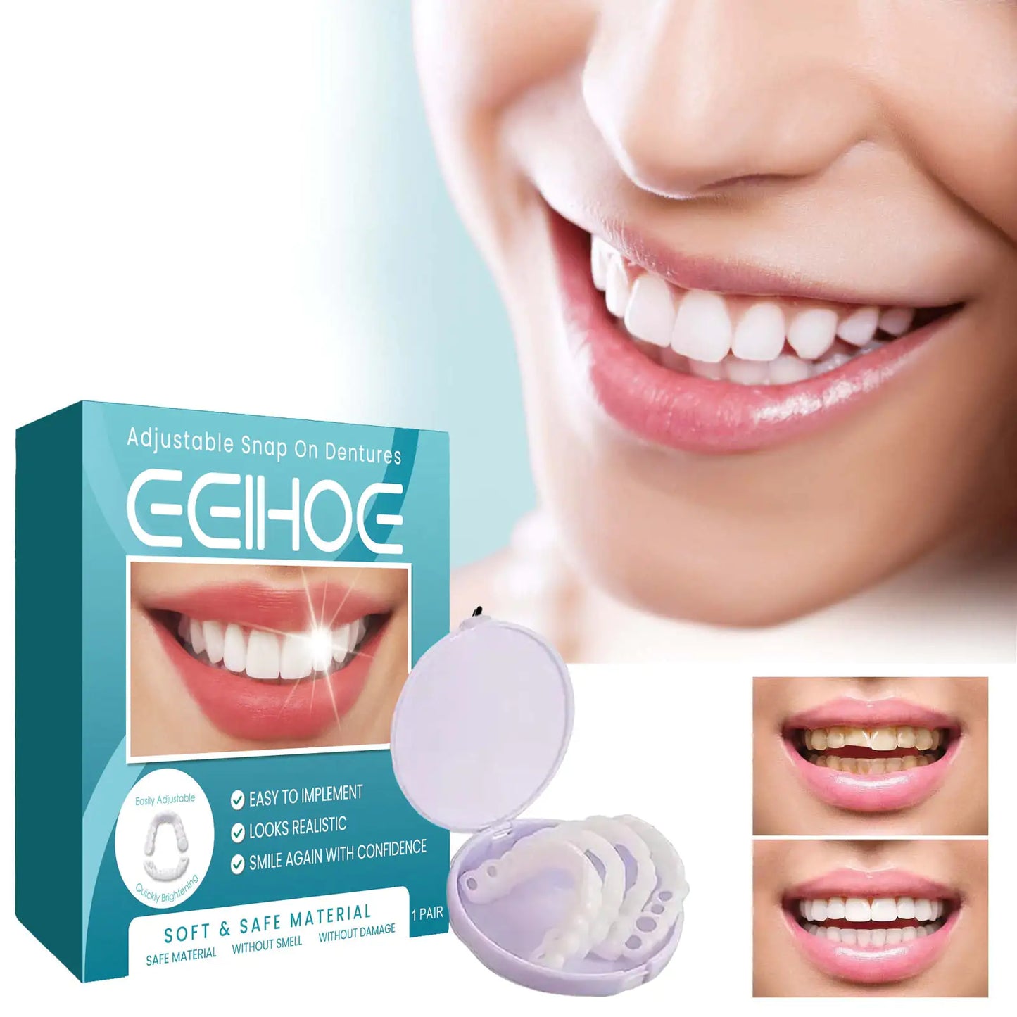 Glamora Adjustable Buckle Denture, Temporary Fillings Interdental Fillings Orthodontic Denture Kits