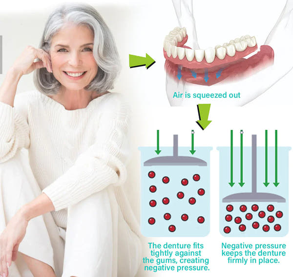 Glamora Adjustable Buckle Denture, Temporary Fillings Interdental Fillings Orthodontic Denture Kits