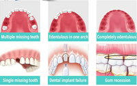 Glamora Adjustable Buckle Denture, Temporary Fillings Interdental Fillings Orthodontic Denture Kits